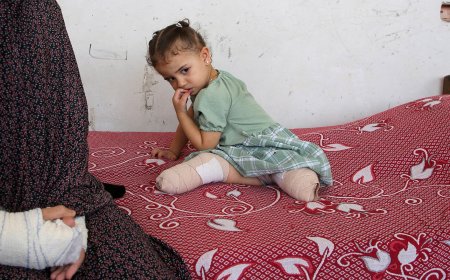 Lives of Gaza’s child amputees forever changed despite ceasefire