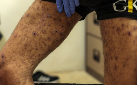 Palestinians released by Israel show signs of ‘torture, starvation’