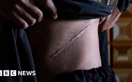 Myanmar villagers reveal 'desperate' illegal kidney sales