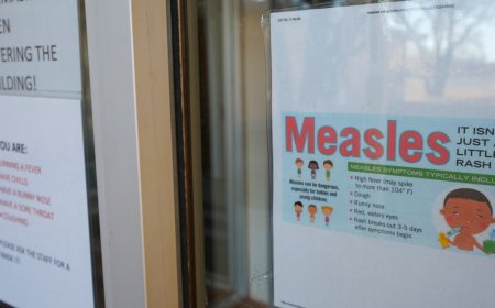 US reports first measles death since 2015