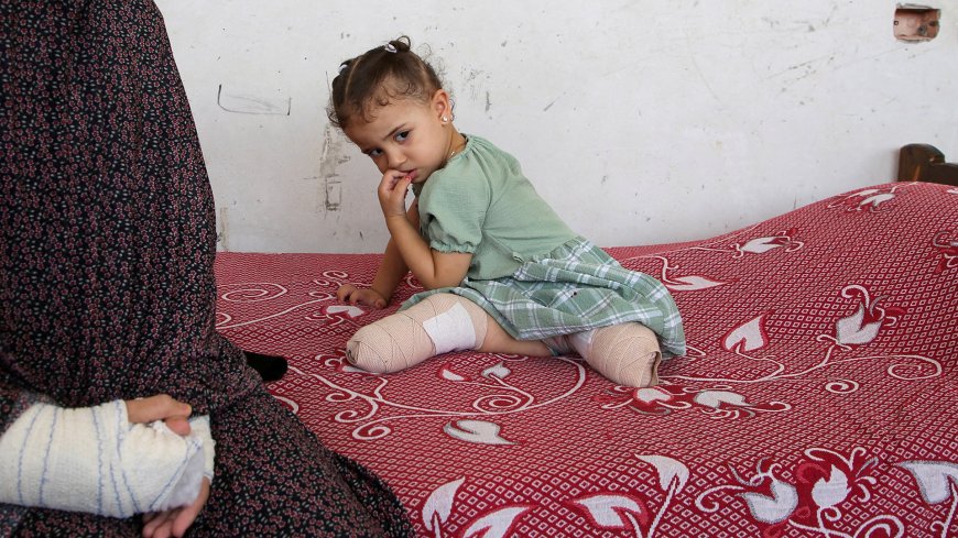 Lives of Gaza’s child amputees forever changed despite ceasefire