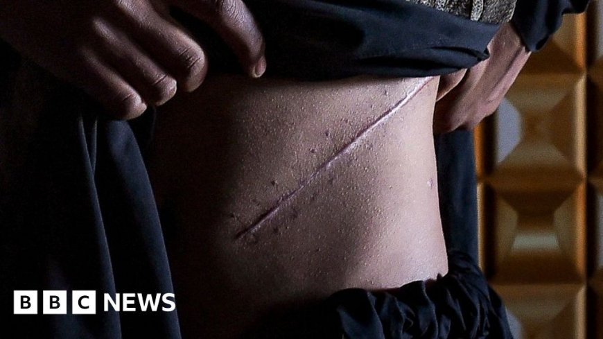 Myanmar villagers reveal 'desperate' illegal kidney sales