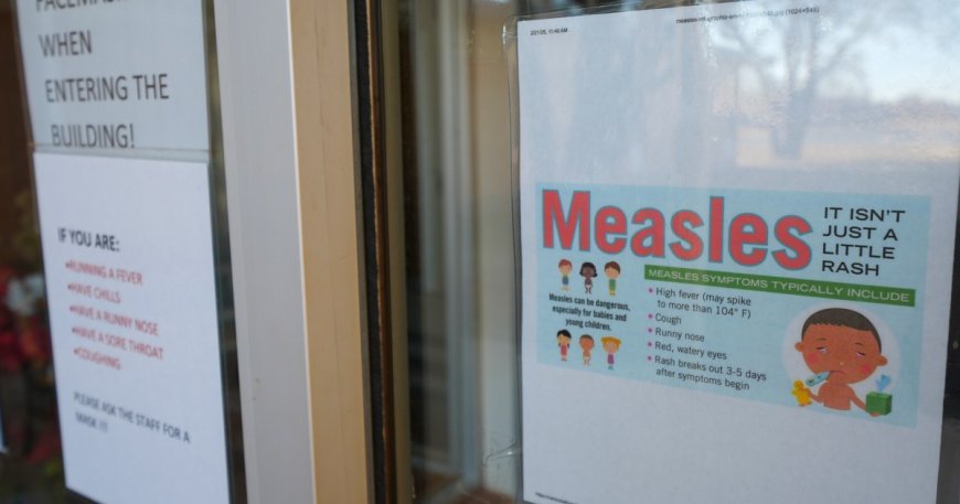 US reports first measles death since 2015